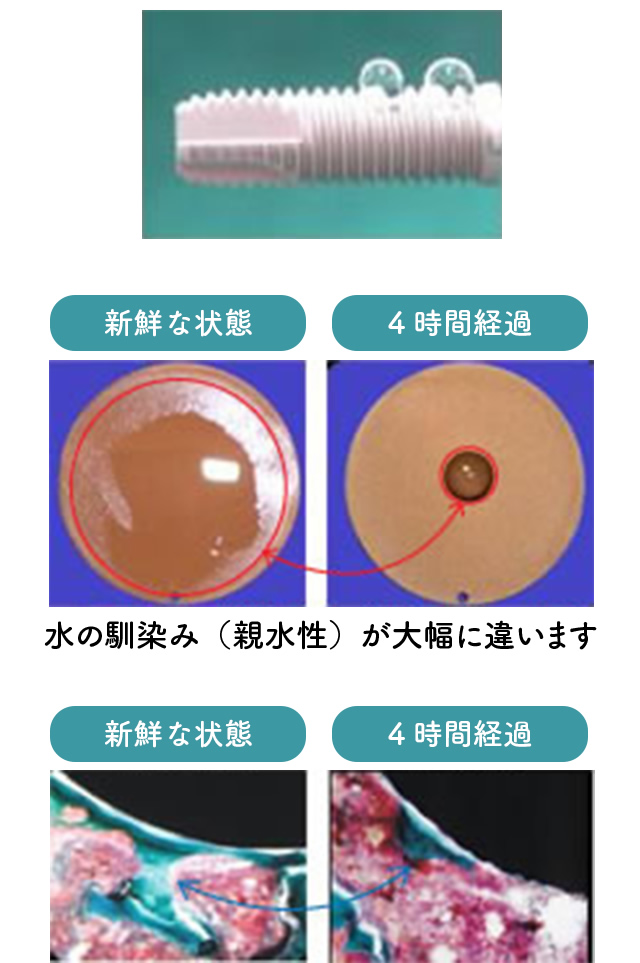 インプラントに水をたらした写真