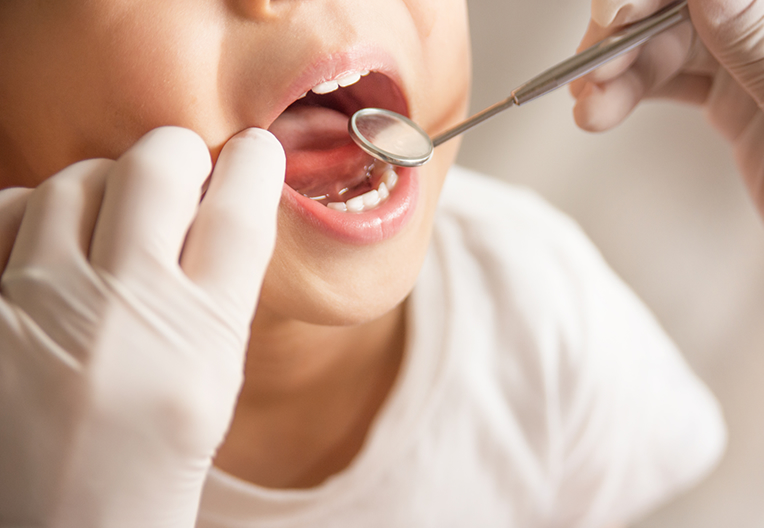 子供の歯科検診の様子